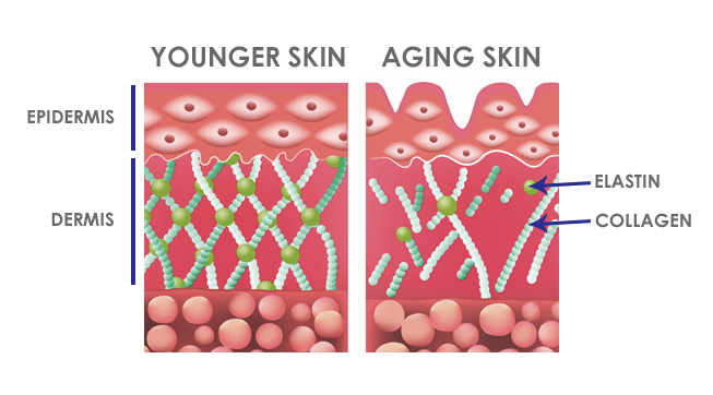 aging skin