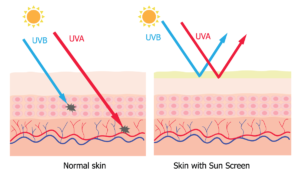 Normal skin vs. skin with sunscreen protection